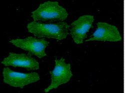 Angiopoietin-like Protein 3/ANGPTL3 Mouse anti-Human, Mouse, Clone: 23D8,